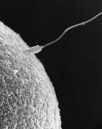 Sperm & Egg - Science Source