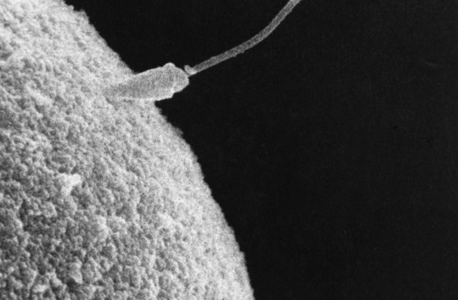 Sperm & Egg - Science Source