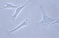 fibroblasts.gif
