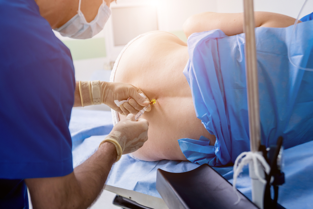 Epidurals Are Used Widely Outside of the Delivery Room, So How do They Work?