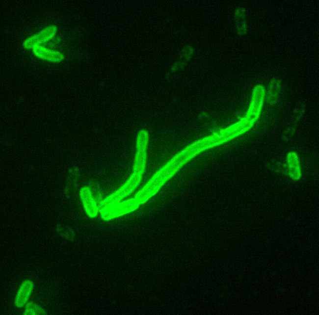 Yersinia_pestis_fluorescent-1024x1012.jpeg