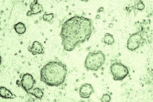stem-cells3.jpg