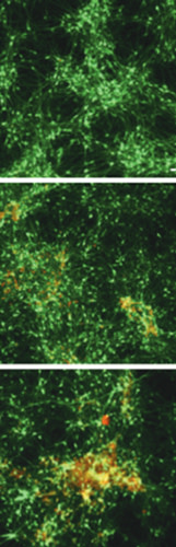 brain-cells