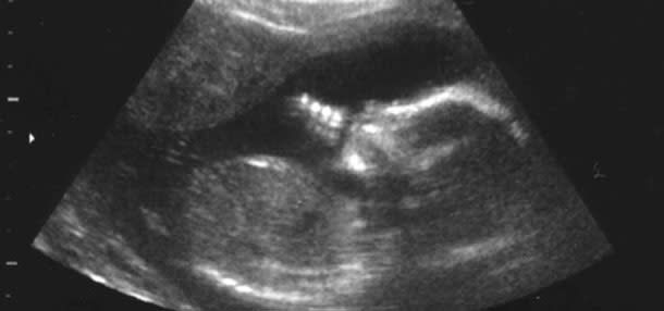 Fetus.jpg