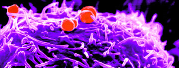 Gonorrhea.jpg