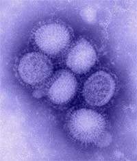 Swineflu.jpg