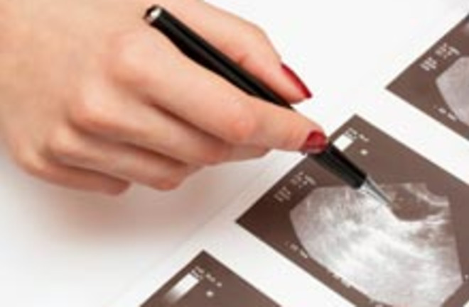 ovary-ultrasound.jpg
