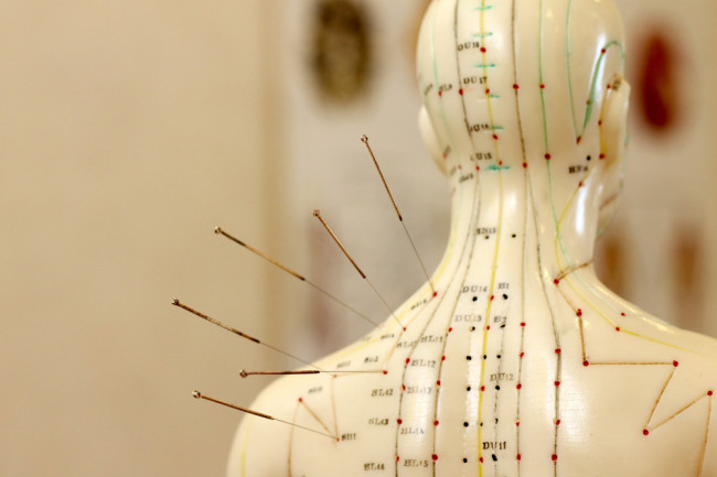 West Palm Beach Acupuncture Treatment