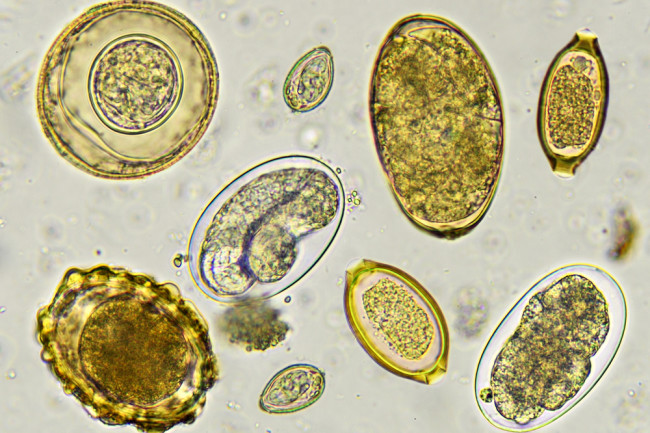 alga helminták kezelése A trichomonák nem gyógyulnak meg