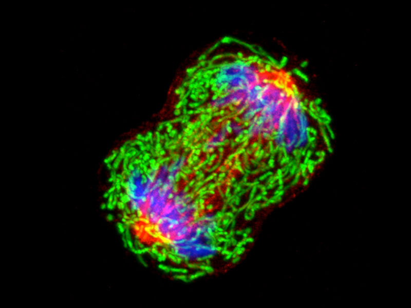 breast cancern cell