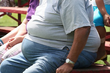 Obese-425x283.jpg