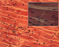 Cardiomyocytes.jpg
