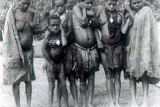 New Guinean Cannibals Evolved Resistance To Mad Cow Like Disease