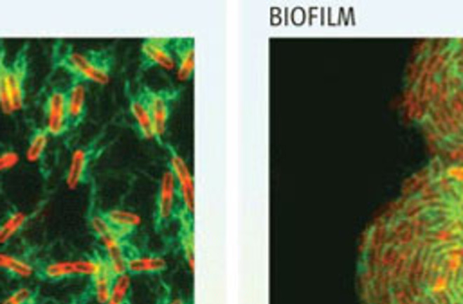 bacteria-biofilm1.jpg