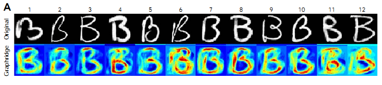 b_brain.png