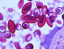 worm-eggs-101201-02.jpg