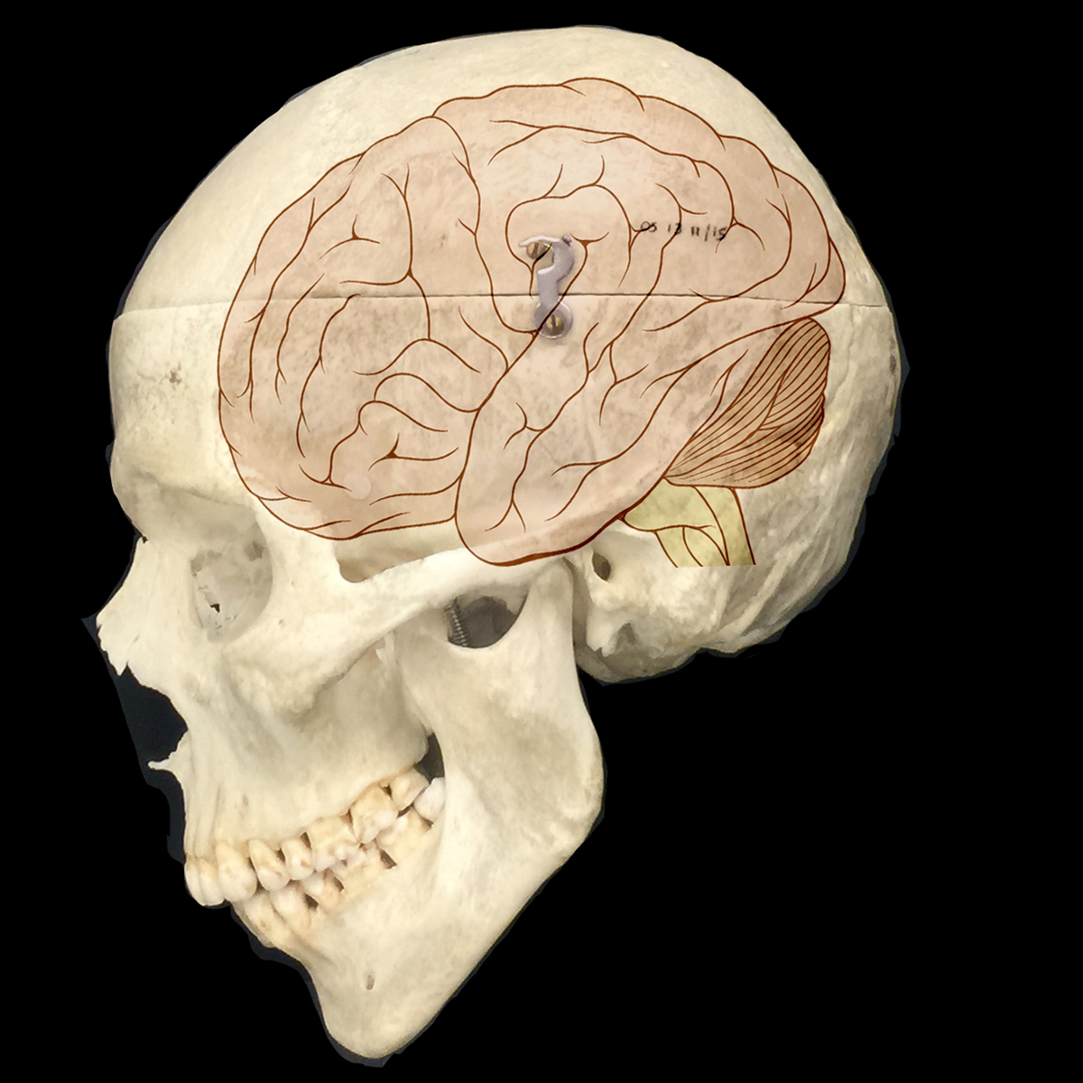 Large brain. Большой мозг. Головной мозг человека в черепе. Череп и мозг человека креативный.