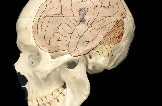 Brain in Skull - Cell