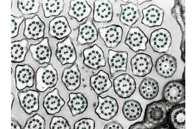 Cilia-Cross-Section
