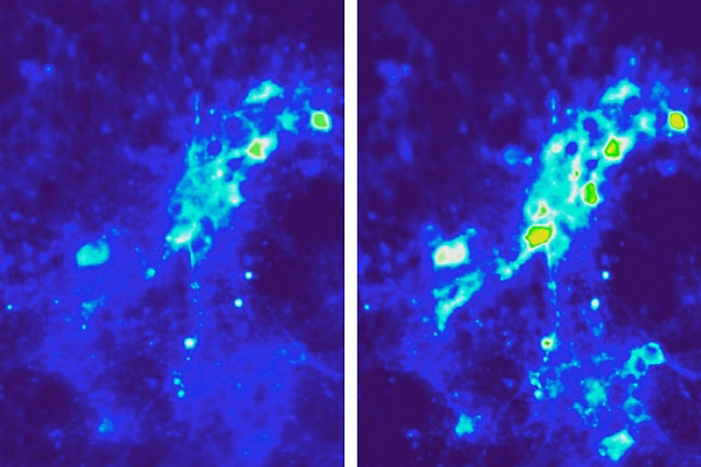 neurons-treated.jpg
