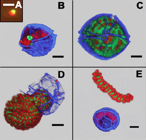 Dinoflagellatparasite.jpg
