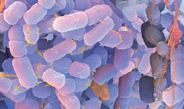 E.coli.jpg