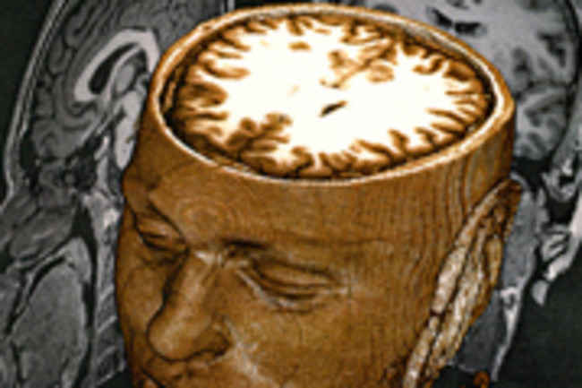 Brain_scans.jpg
