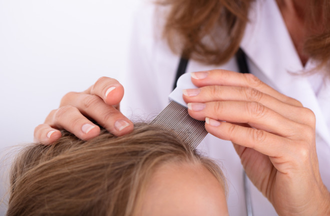 doctor examining child's head for lice - shutterstock 1252772110