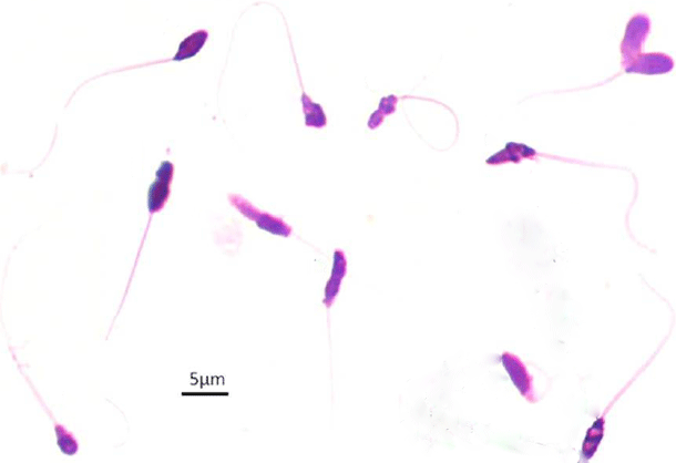 Sperm.gif