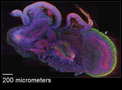 mini_brain_vat.png