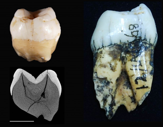 teeth-for-media-1024x802.jpg