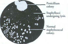 alexander fleming