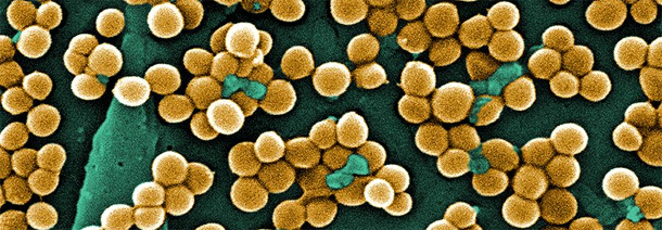 MRSa.gif