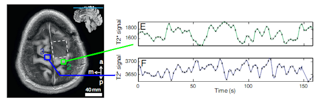 fmri.png