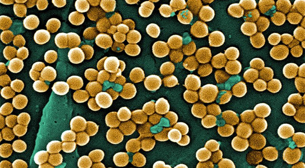 MRSA.jpg