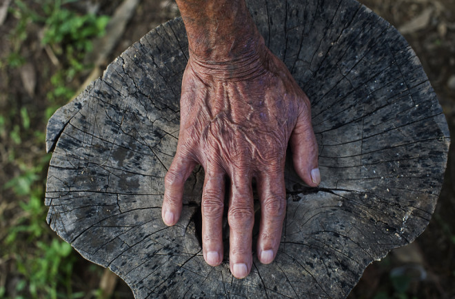 Ancient human hand resting on a wooden tree trunk