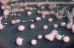 Klebsiella_pneumoniae_01.jpg