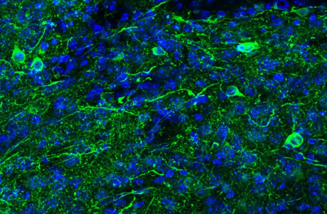 Induced-dopaminergic-neurons-in-green-CREDIT-Lei-Lei-Wang-of-UT-Southwestern-1024x533.jpg