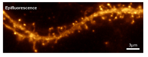 dendrite.png