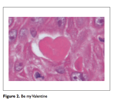 valentines21.png