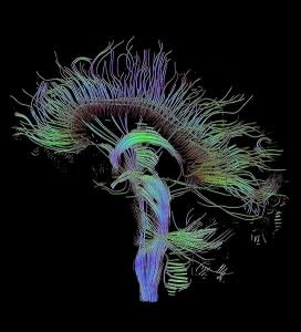 544px-DTI-sagittal-fibers-272x300.jpg