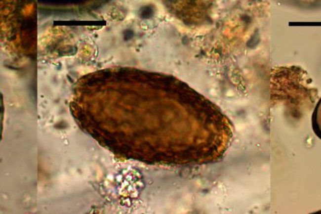 Microscopic Parasites >> Unusual Parasites Plagued Bronze Age Fen Folk And Their Dogs Microscopic Parasites >> Unusual Parasites Plagued Bronze Age Fen Folk And Their Dogs