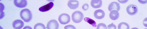 Plasmodium.jpg