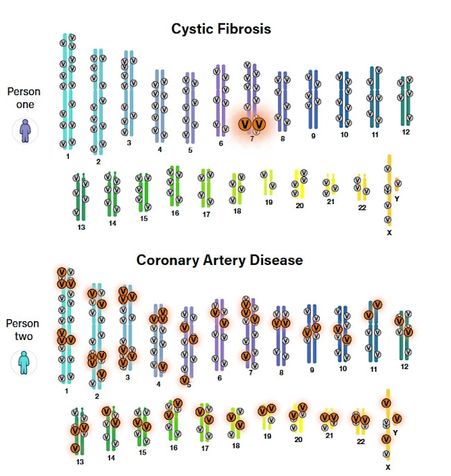 cystic fibrosis heart disease - NIH