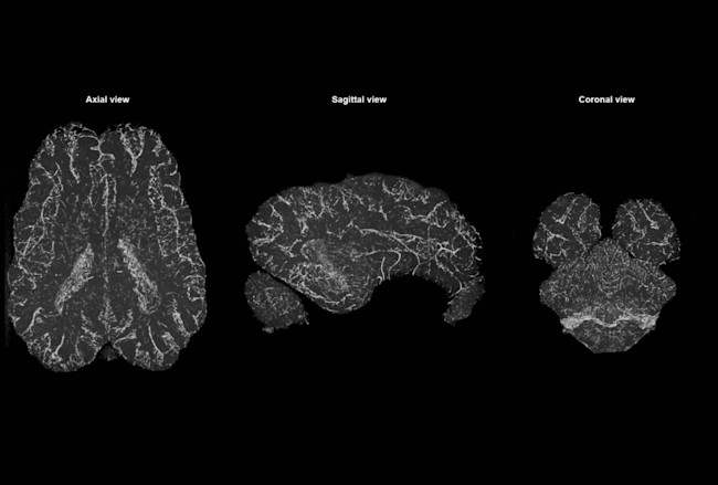 PigBrainActivity-1024x692.jpg