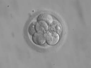 Embryo_8_cells-e1303317615733.jpg