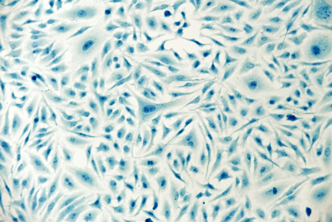 HeLa cervical cancer cells, stained with Coomassie blue, under microscope.