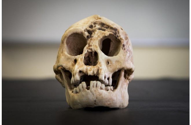 Homo floresiensis skull - ANU