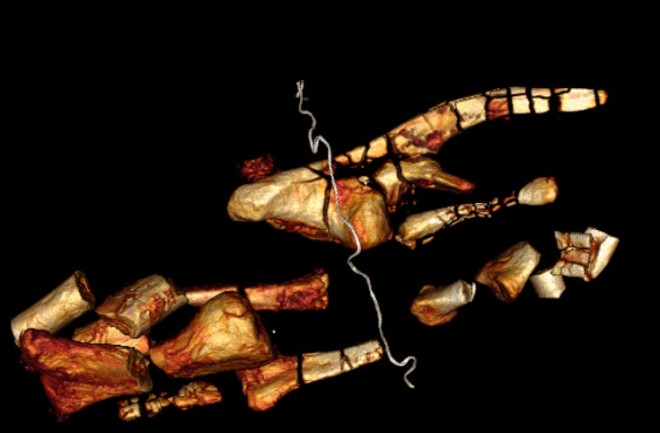 Bones of Dysalotosaurus 