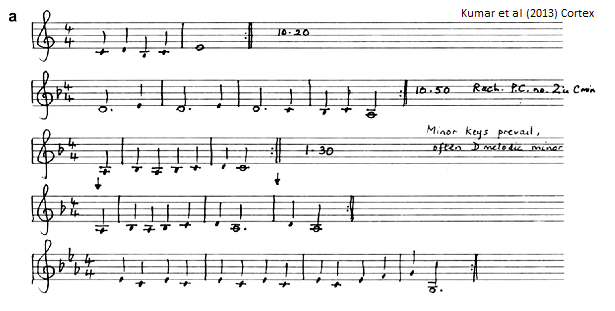 musicalhallucination.png
